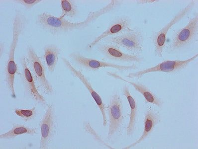 Immunocytochemistry analysis of Hela cells using the antibody at dilution of 1:100Rabbit anti-Human HIST1H4A Polyclonal Antibody