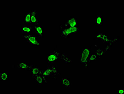 Immunofluorescent analysis of Hela cells treated by NaB using Acetyl-HIST1H4A (K12) Antibody at dilution of 1:100 and Alexa Fluor 488-congugated AffiniPure Goat Anti-Rabbit IgG(H+L)Rabbit anti-Human HIST1H4A Polyclonal Antibody