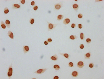 Immunocytochemistry analysis of Butyrly-HIST1H4A (K12) Antibody diluted at 1:150 and staining in Hela cells (treated with 30mM sodium butyrate for 4h) performed on a Leica BondTM system. The cells were fixed in 4% formaldehyde, permeabilized using 0.2% Triton X-100 and blocked with 10% normal goat serum 30min at RT. Then primary antibody (1% BSA) was incubated at 4°C overnight. The primary is detected by a biotinylated secondary antibody and visualized using an HRP conjugated SP system.Rabbit anti-Human HIST1H4A Polyclonal Antibody