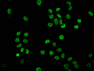 Immunofluorescence staining of Hela cells (treated with 30mM sodium butyrate for 4h) with Butyrly-HIST1H4A (K12) Antibody at 1:75, counter-stained with DAPI. The cells were fixed in 4% formaldehyde, permeabilized using 0.2% Triton X-100 and blocked in 10% normal Goat Serum. The cells were then incubated with the antibody overnight at 4°C. The secondary antibody was Alexa Fluor 488-congugated AffiniPure Goat Anti-Rabbit IgG(H+L).Rabbit anti-Human HIST1H4A Polyclonal Antibody
