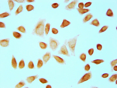 Immunocytochemistry analysis of Formyl-HIST1H4A (K12) Antibody diluted at 1:10 and staining in Hela cells (treated with 30mM sodium butyrate for 4h) performed on a Leica BondTM system. The cells were fixed in 4% formaldehyde, permeabilized using 0.2% Triton X-100 and blocked with 10% normal goat serum 30min at RT. Then primary antibody (1% BSA) was incubated at 4°C overnight. The primary is detected by a biotinylated secondary antibody and visualized using an HRP conjugated SP system.Rabbit anti-Human HIST1H4A Polyclonal Antibody