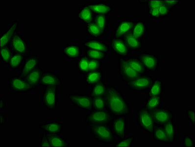 Immunofluorescence staining of Hela cells (treated with 30mM sodium butyrate for 4h) with Formyl-HIST1H4A (K12) Antibody at 1:5, counter-stained with DAPI. The cells were fixed in 4% formaldehyde, permeabilized using 0.2% Triton X-100 and blocked in 10% normal Goat Serum. The cells were then incubated with the antibody overnight at 4°C. The secondary antibody was Alexa Fluor 488-congugated AffiniPure Goat Anti-Rabbit IgG(H+L).Rabbit anti-Human HIST1H4A Polyclonal Antibody