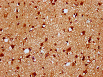 IHC image of HIST1H4A (Ab-12) Antibody diluted at 1:20 and staining in paraffin-embedded human brain tissue performed on a Leica BondTM system. After dewaxing and hydration, antigen retrieval was mediated by high pressure in a citrate buffer (pH 6.0). Section was blocked with 10% normal goat serum 30min at RT. Then primary antibody (1% BSA) was incubated at 4°C overnight. The primary is detected by a biotinylated secondary antibody and visualized using an HRP conjugated SP system.Rabbit anti-Human HIST1H4A Polyclonal Antibody