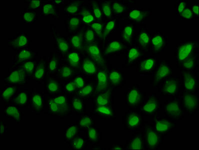 Immunofluorescence staining of Hela cells with HIST1H4A (Ab-12) Antibody at 1:10, counter-stained with DAPI. The cells were fixed in 4% formaldehyde, permeabilized using 0.2% Triton X-100 and blocked in 10% normal Goat Serum. The cells were then incubated with the antibody overnight at 4°C. The secondary antibody was Alexa Fluor 488-congugated AffiniPure Goat Anti-Rabbit IgG(H+L).Rabbit anti-Human HIST1H4A Polyclonal Antibody