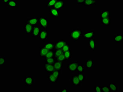 Immunofluorescence staining of Hela cells (treated with 30mM sodium butyrate for 4h) with Butyrly-HIST1H4A (K16) Antibody at 1:5, counter-stained with DAPI. The cells were fixed in 4% formaldehyde, permeabilized using 0.2% Triton X-100 and blocked in 10% normal Goat Serum. The cells were then incubated with the antibody overnight at 4°C. The secondary antibody was Alexa Fluor 488-congugated AffiniPure Goat Anti-Rabbit IgG(H+L).Rabbit anti-Human HIST1H4A Polyclonal Antibody