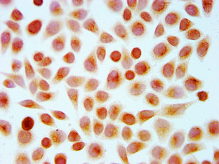 Immunocytochemistry analysis of Crotonyl-HIST1H4A (K16) Antibody diluted at 1:10 and staining in Hela cells (treated with 30mM sodium crotonylate for 4h) performed on a Leica BondTM system. The cells were fixed in 4% formaldehyde, permeabilized using 0.2% Triton X-100 and blocked with 10% normal goat serum 30min at RT. Then primary antibody (1% BSA) was incubated at 4°C overnight. The primary is detected by a biotinylated secondary antibody and visualized using an HRP conjugated SP system.Rabbit anti-Human HIST1H4A Polyclonal Antibody