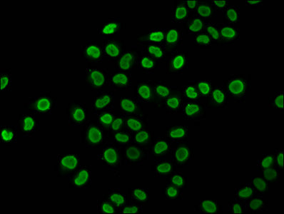 Immunofluorescence staining of Hela cells (treated with 30mM sodium butyrate for 4h) with 2-hydroxyisobutyryl-HIST1H4A (K16) Antibody at 1:5, counter-stained with DAPI. The cells were fixed in 4% formaldehyde, permeabilized using 0.2% Triton X-100 and blocked in 10% normal Goat Serum. The cells were then incubated with the antibody overnight at 4°C. The secondary antibody was Alexa Fluor 488-congugated AffiniPure Goat Anti-Rabbit IgG(H+L).Rabbit anti-Human HIST1H4A Polyclonal Antibody