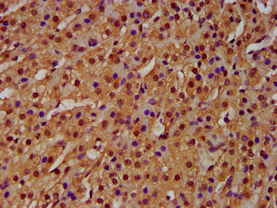 IHC image of HIST1H4A (Ab-20) Antibody diluted at 1:100 and staining in paraffin-embedded human adrenal gland tissue performed on a Leica BondTM system. After dewaxing and hydration, antigen retrieval was mediated by high pressure in a citrate buffer (pH 6.0). Section was blocked with 10% normal goat serum 30min at RT. Then primary antibody (1% BSA) was incubated at 4°C overnight. The primary is detected by a biotinylated secondary antibody and visualized using an HRP conjugated SP system.Rabbit anti-Human HIST1H4A Polyclonal Antibody