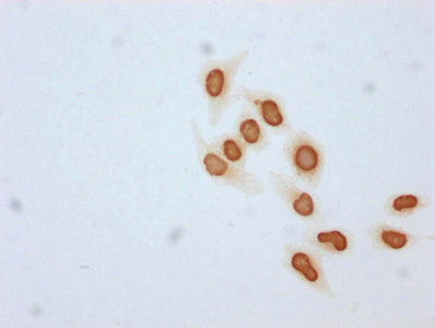 Immunocytochemistry analysis of Acetyl-HIST1H4A (K31) Antibody diluted at 1:25 and staining in Hela cells (treated with 30mM sodium butyrate for 4h) performed on a Leica BondTM system. The cells were fixed in 4% formaldehyde, permeabilized using 0.2% Triton X-100 and blocked with 10% normal goat serum 30min at RT. Then primary antibody (1% BSA) was incubated at 4°C overnight. The primary is detected by a biotinylated secondary antibody and visualized using an HRP conjugated SP system.Rabbit anti-Human HIST1H4A Polyclonal Antibody