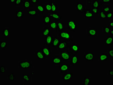 Immunofluorescence staining of Hela cells (treated with 30mM sodium butyrate for 4h) with Acetyl-HIST1H4A (K31) Antibody at 1:12.5, counter-stained with DAPI. The cells were fixed in 4% formaldehyde, permeabilized using 0.2% Triton X-100 and blocked in 10% normal Goat Serum. The cells were then incubated with the antibody overnight at 4°C. The secondary antibody was Alexa Fluor 488-congugated AffiniPure Goat Anti-Rabbit IgG(H+L).Rabbit anti-Human HIST1H4A Polyclonal Antibody