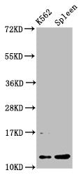 Western Blot  | Positive WB detected in: K562 whole cell lysate, Rat spleen tissue  | All lanes: HIST1H4A antibody at 0.53µg/ml  | Secondary  | Goat polyclonal to rabbit IgG at 1/50000 dilution  | Predicted band size: 12 kDa  | Observed band size: 12 kDaRabbit anti-Human HIST1H4A Polyclonal Antibody