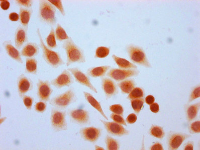 Immunocytochemistry analysis of Formyl-HIST1H4A (K77) Antibody diluted at 1:30 and staining in Hela cells (treated with 30mM sodium butyrate for 4h) performed on a Leica BondTM system. The cells were fixed in 4% formaldehyde, permeabilized using 0.2% Triton X-100 and blocked with 10% normal goat serum 30min at RT. Then primary antibody (1% BSA) was incubated at 4°C overnight. The primary is detected by a biotinylated secondary antibody and visualized using an HRP conjugated SP system.Rabbit anti-Human HIST1H4A Polyclonal Antibody