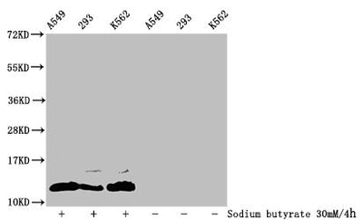 Western Blot  | Detected samples: A549 whole cell lysate, 293 whole cell lysate, K562 whole cell lysate; Untreated (-) or treated (+) with 30mM sodium butyrate for 4h  | All lanes: HIST1H4A antibody at 1:100  | Secondary  | Goat polyclonal to rabbit IgG at 1/50000 dilution  | Predicted band size: 12 kDa  | Observed band size: 12 kDaRabbit anti-Human HIST1H4A Polyclonal Antibody
