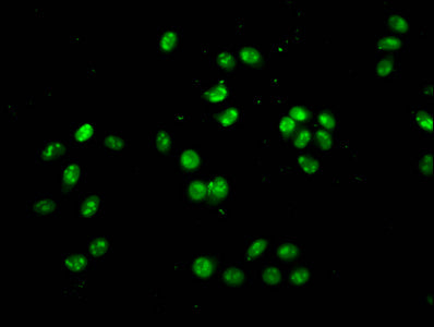 Immunofluorescence staining of Hela cells with HIST1H4A (Ab-77) Antibody at 1:2.5, counter-stained with DAPI. The cells were fixed in 4% formaldehyde, permeabilized using 0.2% Triton X-100 and blocked in 10% normal Goat Serum. The cells were then incubated with the antibody overnight at 4°C. The secondary antibody was Alexa Fluor 488-congugated AffiniPure Goat Anti-Rabbit IgG(H+L).Rabbit anti-Human HIST1H4A Polyclonal Antibody