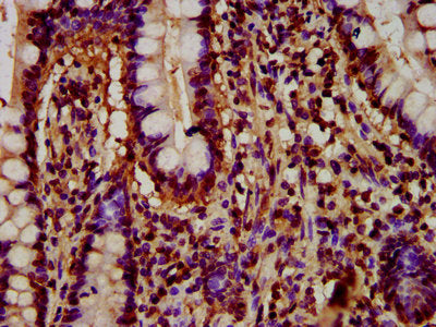 IHC image of HIST1H4A (Ab-77) Antibody diluted at 1:5 and staining in paraffin-embedded human small intestine tissue performed on a Leica BondTM system. After dewaxing and hydration, antigen retrieval was mediated by high pressure in a citrate buffer (pH 6.0). Section was blocked with 10% normal goat serum 30min at RT. Then primary antibody (1% BSA) was incubated at 4°C overnight. The primary is detected by a biotinylated secondary antibody and visualized using an HRP conjugated SP system.Rabbit anti-Human HIST1H4A Polyclonal Antibody