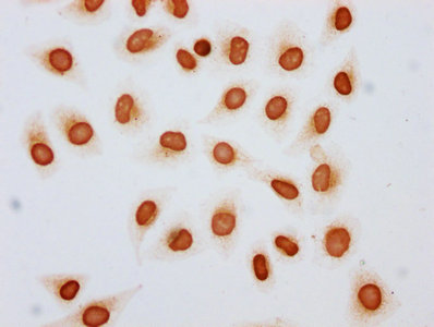 Immunocytochemistry analysis of the antibody diluted at 1:10 and staining in Hela cells (treated with 30mM sodium butyrate for 4h) performed on a Leica BondTM system. The cells were fixed in 4% formaldehyde, permeabilized using 0.2% Triton X-100 and blocked with 10% normal goat serum 30min at RT. Then primary antibody (1% BSA) was incubated at 4°C overnight. The primary is detected by a biotinylated secondary antibody and visualized using an HRP conjugated SP system.Rabbit anti-Human HIST1H4A Polyclonal Antibody
