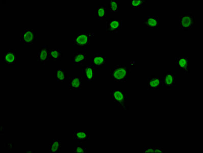 Immunofluorescence staining of Hela cells (treated with 30mM sodium butyrate for 4h) with Acetyl-HIST1H4A (K79) Antibody at 1:5, counter-stained with DAPI. The cells were fixed in 4% formaldehyde, permeabilized using 0.2% Triton X-100 and blocked in 10% normal Goat Serum. The cells were then incubated with the antibody overnight at 4°C. The secondary antibody was Alexa Fluor 488-congugated AffiniPure Goat Anti-Rabbit IgG(H+L).Rabbit anti-Human HIST1H4A Polyclonal Antibody