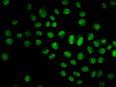 Immunofluorescence staining of Hela cells with HIST1H4A (Ab-79) Antibody at 1:10, counter-stained with DAPI. The cells were fixed in 4% formaldehyde, permeabilized using 0.2% Triton X-100 and blocked in 10% normal Goat Serum. The cells were then incubated with the antibody overnight at 4°C. The secondary antibody was Alexa Fluor 488-congugated AffiniPure Goat Anti-Rabbit IgG(H+L).Rabbit anti-Human HIST1H4A Polyclonal Antibody