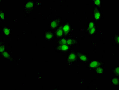 Immunofluorescence staining of Hela cells with HIST1H4A (Ab-88) Antibody at 1:1, counter-stained with DAPI. The cells were fixed in 4% formaldehyde, permeabilized using 0.2% Triton X-100 and blocked in 10% normal Goat Serum. The cells were then incubated with the antibody overnight at 4°C. The secondary antibody was Alexa Fluor 488-congugated AffiniPure Goat Anti-Rabbit IgG(H+L).Rabbit anti-Human HIST1H4A Polyclonal Antibody