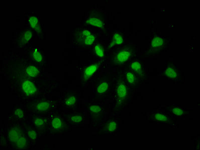 Immunofluorescence staining of Hela cells with HIST1H4A (Ab-91) Antibody at 1:2.5, counter-stained with DAPI. The cells were fixed in 4% formaldehyde, permeabilized using 0.2% Triton X-100 and blocked in 10% normal Goat Serum. The cells were then incubated with the antibody overnight at 4°C. The secondary antibody was Alexa Fluor 488-congugated AffiniPure Goat Anti-Rabbit IgG(H+L).Rabbit anti-Human HIST1H4A Polyclonal Antibody