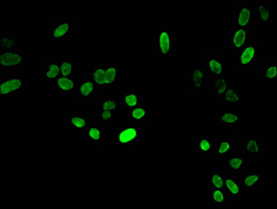 Immunofluorescent analysis of Hela cells using HIST1H4A (Ab-3) Antibody at dilution of 1:100 and Alexa Fluor 488-congugated AffiniPure Goat Anti-Rabbit IgG(H+L)Rabbit anti-Human HIST1H4A Polyclonal Antibody