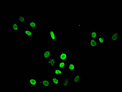Immunofluorescent analysis of Hela cells treated with NaB using Acetyl-HIST1H4A (K8) Antibody at dilution of 1:100 and Alexa Fluor 488-congugated AffiniPure Goat Anti-Rabbit IgG(H+L)Rabbit anti-Human HIST1H4A Polyclonal Antibody