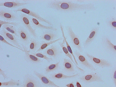 Immunocytochemistry analysis of Hela cells using the antibody at dilution of 1:100Rabbit anti-Human HIST1H4A Polyclonal Antibody