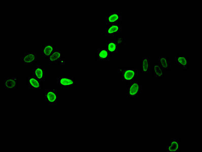 Immunofluorescent analysis of Hela cells treated by NaB using Acetyl-HIST1H4A (K12) Antibody at dilution of 1:100 and Alexa Fluor 488-congugated AffiniPure Goat Anti-Rabbit IgG(H+L)Rabbit anti-Human HIST1H4A Polyclonal Antibody