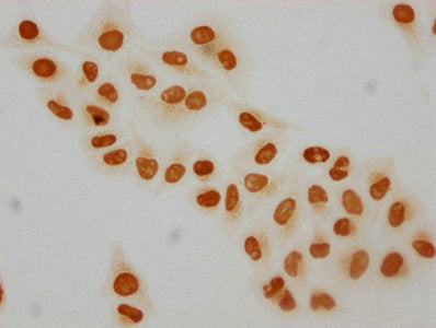 Immunocytochemistry analysis of 2-hydroxyisobutyryl-HIST1H4A (K12) Antibody diluted at 1:30 and staining in Hela cells (treated with 30mM sodium butyrate for 4h) performed on a Leica BondTM system. The cells were fixed in 4% formaldehyde, permeabilized using 0.2% Triton X-100 and blocked with 10% normal goat serum 30min at RT. Then primary antibody (1% BSA) was incubated at 4°C overnight. The primary is detected by a biotinylated secondary antibody and visualized using an HRP conjugated SP system.Rabbit anti-Human HIST1H4A Polyclonal Antibody