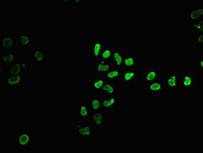 Immunofluorescence staining of Hela cells (treated with 30mM sodium butyrate for 4h) with 2-hydroxyisobutyryl-HIST1H4A (K12) Antibody at 1:15, counter-stained with DAPI. The cells were fixed in 4% formaldehyde, permeabilized using 0.2% Triton X-100 and blocked in 10% normal Goat Serum. The cells were then incubated with the antibody overnight at 4°C. The secondary antibody was Alexa Fluor 488-congugated AffiniPure Goat Anti-Rabbit IgG(H+L).Rabbit anti-Human HIST1H4A Polyclonal Antibody