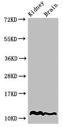 Western Blot  | Positive WB detected in: Mouse kidney tissue, Mouse brain tissue  | All lanes: HIST1H4A antibody at 2µg/ml  | Secondary  | Goat polyclonal to rabbit IgG at 1/50000 dilution  | Predicted band size: 12 kDa  | Observed band size: 12 kDaRabbit anti-Human HIST1H4A Polyclonal Antibody