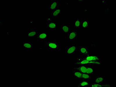 Immunofluorescent analysis of Hela cells using HIST1H4A (Ab-16) Antibody at dilution of 1:100 and Alexa Fluor 488-congugated AffiniPure Goat Anti-Rabbit IgG(H+L)Rabbit anti-Human HIST1H4A Polyclonal Antibody