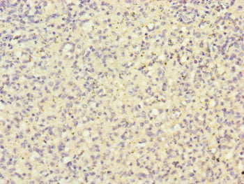 Immunohistochemistry of paraffin-embedded human spleen tissue using HK3 Antibody at dilution of 1:100Rabbit anti-Human HK3 Polyclonal Antibody