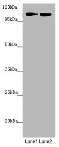 Western blot | All lanes: HK3 antibody at 1.47 μg/ml | Lane 1: Mouse liver tissue | Lane 2: Mouse kidney tissue | Secondary | Goat polyclonal to rabbit IgG at 1/10000 dilution | Predicted band size: 99 kDa | Observed band size: 99 kDaRabbit anti-Human HK3 Polyclonal Antibody