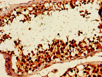 Immunohistochemistry of paraffin-embedded human testis tissue using HLTF Antibody at dilution of 1:100Rabbit anti-Human HLTF Polyclonal Antibody