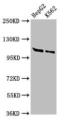 Western Blot | Positive WB detected in: HepG2 whole cell lysate, K562 whole cell lysate | All lanes: HLTF antibody at 3μg/ml | Secondary | Goat polyclonal to rabbit IgG at 1/50000 dilution | Predicted band size: 114, 100 kDa | Observed band size: 114 kDaRabbit anti-Human HLTF Polyclonal Antibody