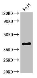 Western Blot  | Positive WB detected in: Raji whole cell lysate  | All lanes: HMBS antibody at 3µg/ml  | Secondary  | Goat polyclonal to rabbit IgG at 1/50000 dilution  | Predicted band size: 40, 38, 35, 34 kDa  | Observed band size: 40 kDaRabbit anti-Human HMBS Polyclonal Antibody