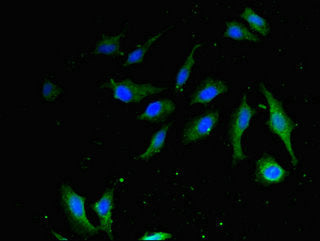 Immunofluorescent analysis of Hela cells using HMGB1 Antibody at dilution of 1:100 and Alexa Fluor 488-congugated AffiniPure Goat Anti-Rabbit IgG(H+L)Rabbit anti-Human HMGB1 Polyclonal Antibody