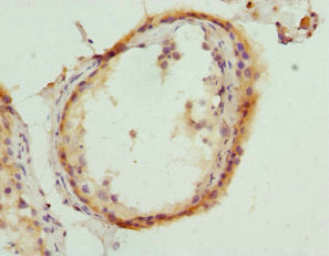 Immunohistochemistry of paraffin-embedded human testis tissue using HMGCL Antibody at dilution of 1:100Rabbit anti-Human HMGCL Polyclonal Antibody