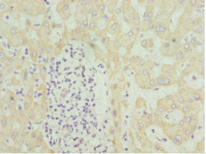 Immunohistochemistry of paraffin-embedded human liver tissue using HMGCL Antibody at dilution of 1:100Rabbit anti-Human HMGCL Polyclonal Antibody