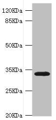 Western blot | All lanes: HMGCL antibody at 0.8μg/ml + Rat liver tissue | Secondary | Goat polyclonal to rabbit IgG at 1/10000 dilution | Predicted band size: 35, 27, 21 kDa | Observed band size: 35 kDaRabbit anti-Human HMGCL Polyclonal Antibody