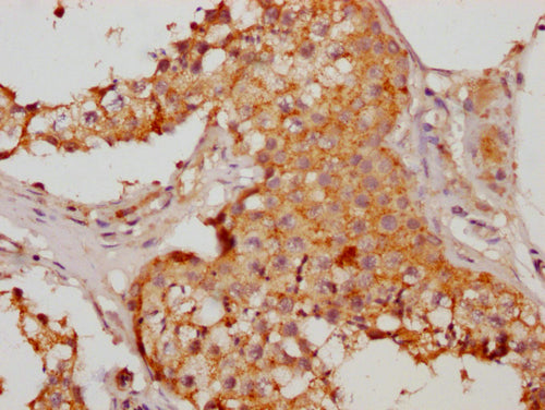 IHC image of HMGCL Antibody diluted at 1:200 and staining in paraffin-embedded human testis tissue performed on a Leica BondTM system. After dewaxing and hydration, antigen retrieval was mediated by high pressure in a citrate buffer (pH 6.0). Section was blocked with 10% normal goat serum 30min at RT. Then primary antibody (1% BSA) was incubated at 4°C overnight. The primary is detected by a Goat anti-rabbit polymer IgG labeled by HRP and visualized using 0.05% DAB.Rabbit anti-Human HMGCL Polyclonal Antibody