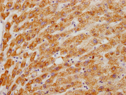 IHC image of HMGCL Antibody diluted at 1:200 and staining in paraffin-embedded human liver tissue performed on a Leica BondTM system. After dewaxing and hydration, antigen retrieval was mediated by high pressure in a citrate buffer (pH 6.0). Section was blocked with 10% normal goat serum 30min at RT. Then primary antibody (1% BSA) was incubated at 4°C overnight. The primary is detected by a Goat anti-rabbit polymer IgG labeled by HRP and visualized using 0.05% DAB.Rabbit anti-Human HMGCL Polyclonal Antibody