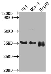 Western Blot | Positive WB detected in: U87 whole cell lysate, MCF-7 whole cell lysate, HepG2 whole cell lysate | All lanes: HMGCL antibody at 1:2000 | Secondary | Goat polyclonal to rabbit IgG at 1/50000 dilution | Predicted band size: 35, 27, 21 kDa | Observed band size: 35 kDaRabbit anti-Human HMGCL Polyclonal Antibody