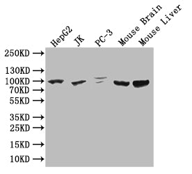 Western BlotPositive WB detected in: HepG2 whole cell lysate, JK whole cell lysate,PC-3 whole cell lysate,Mouse Brain tissue lysate, Mouse Liver tissue lysateAll lanes: HMGCR antibody at 1:1000SecondaryGoat polyclonal to rabbit IgG at 1/50000 dilutionPredicted band size: 98 kDaObserved band size: 100 kDaRabbit anti-Human HMGCR Polyclonal Antibody
