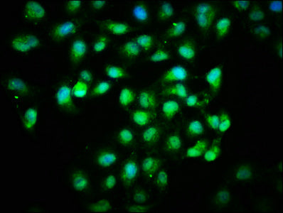 Immunofluorescence staining of Hela cells with HMGCS1 Antibody at 1:166, counter-stained with DAPI. The cells were fixed in 4% formaldehyde, permeabilized using 0.2% Triton X-100 and blocked in 10% normal Goat Serum. The cells were then incubated with the antibody overnight at 4°C. The secondary antibody was Alexa Fluor 488-congugated AffiniPure Goat Anti-Rabbit IgG(H+L).Rabbit anti-Human HMGCS1 Polyclonal Antibody