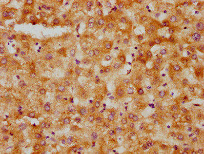 IHC image of the antibody diluted at 1:500 and staining in paraffin-embedded human liver tissue performed on a Leica BondTM system. After dewaxing and hydration, antigen retrieval was mediated by high pressure in a citrate buffer (pH 6.0). Section was blocked with 10% normal goat serum 30min at RT. Then primary antibody (1% BSA) was incubated at 4°C overnight. The primary is detected by a biotinylated secondary antibody and visualized using an HRP conjugated SP system.Rabbit anti-Human HMGCS1 Polyclonal Antibody