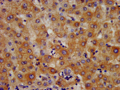 IHC image of HMGCS2 Antibody diluted at 1:400 and staining in paraffin-embedded human liver tissue performed on a Leica BondTM system. After dewaxing and hydration, antigen retrieval was mediated by high pressure in a citrate buffer (pH 6.0). Section was blocked with 10% normal goat serum 30min at RT. Then primary antibody (1% BSA) was incubated at 4°C overnight. The primary is detected by a biotinylated secondary antibody and visualized using an HRP conjugated SP system.Rabbit anti-Human HMGCS2 Polyclonal Antibody