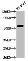 Western Blot | Positive WB detected in: Rat kidney tissue | All lanes: HMGCS2 antibody at 4.5μg/ml | Secondary | Goat polyclonal to rabbit IgG at 1/50000 dilution | Predicted band size: 57, 53, 51 kDa | Observed band size: 57 kDaRabbit anti-Human HMGCS2 Polyclonal Antibody