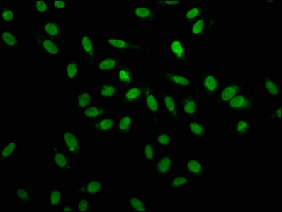 Immunofluorescence staining of Hela cells with the antibody at 1:100, counter-stained with DAPI. The cells were fixed in 4% formaldehyde, permeabilized using 0.2% Triton X-100 and blocked in 10% normal Goat Serum. The cells were then incubated with the antibody overnight at 4°C. The secondary antibody was Alexa Fluor 488-congugated AffiniPure Goat Anti-Rabbit IgG(H+L).Rabbit anti-Human HNRNPA1 Polyclonal Antibody